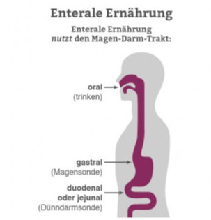 Enterale Ernhrung - Sanittshaus Fendel & Keuchen